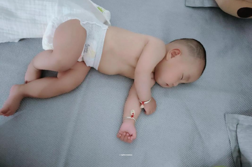 白山六个月宝宝眼睛散光